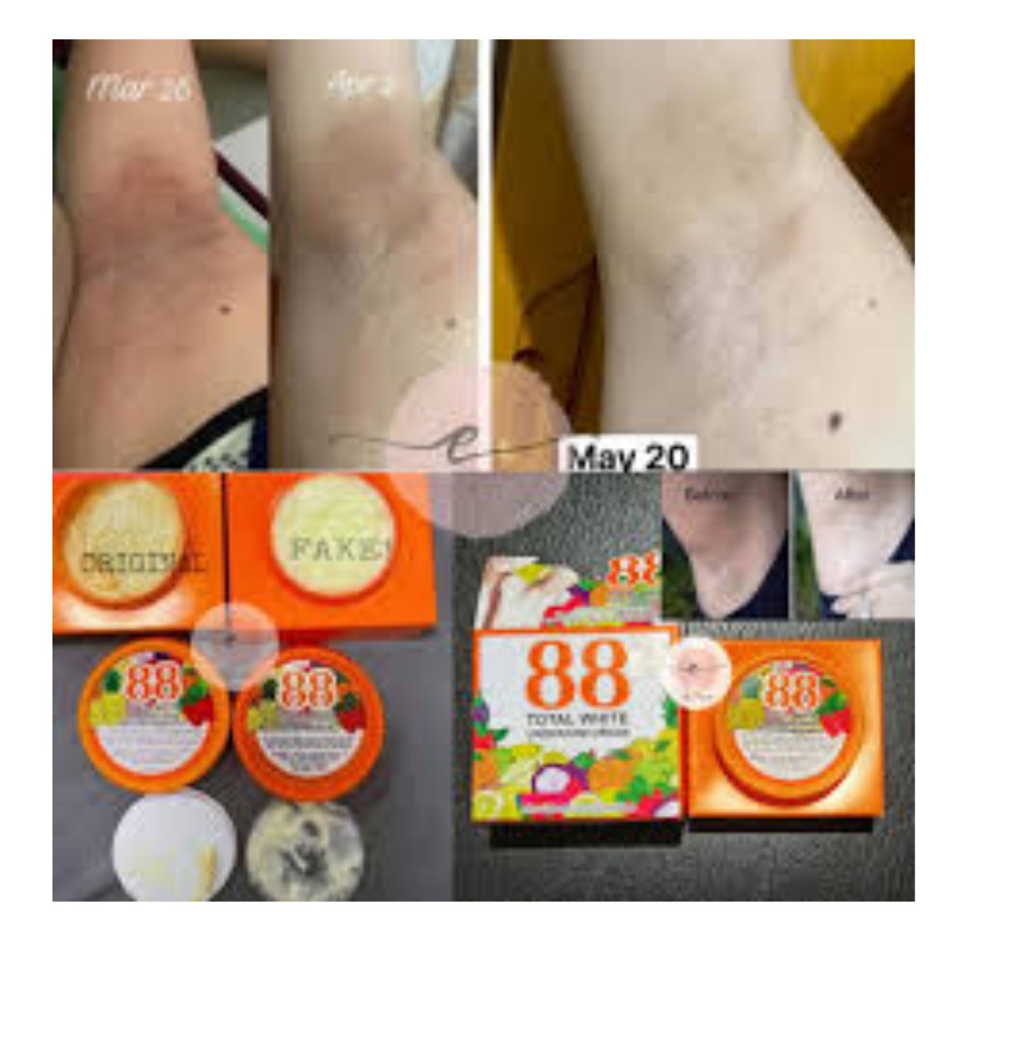 88 TOTAL WHITE UNDERARM CRÈME ECLAIRCISSANTE AISSELLES FINIS les odeurs, GENOUX, QUITONS THAÏLANDE 35g