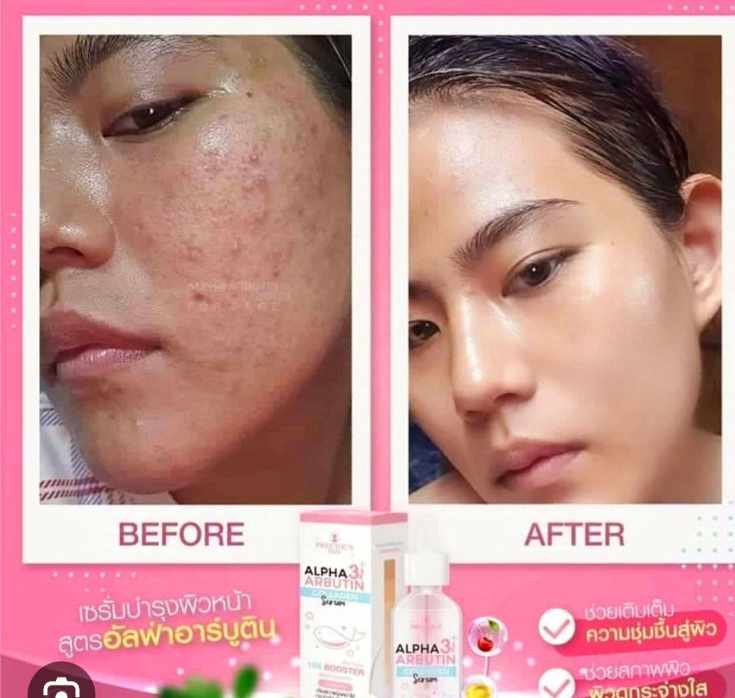 ALPHA ARBUTIN SÉRUM ÉCLAIRCISSANT VISAGE BOOSTER DE TEINT TRIPLE ACTION