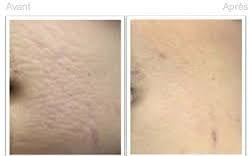 LAZEL GLUTA PUR GLUTATHIONE 30 GELULES