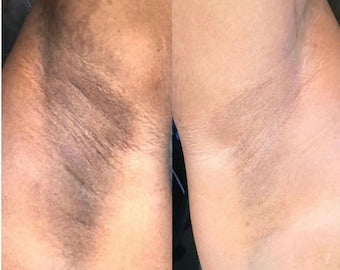 X3 KOJIE•SAN SAVON ECLAIRCISSANT ORIGINAL CONTRE LES TÂCHES, LES BOUTONS, HYPER PIGMENTATION