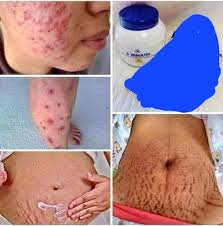 AR VITAMINE E, CRÈME RÉPARATRICE, VERGETURES, ET SAVON 200ml, 100g