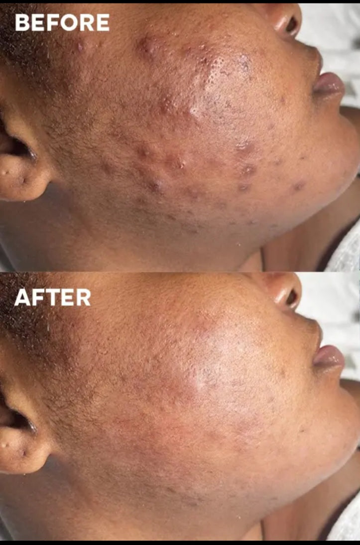 CRÈME ECLAIRCISSANTE CORRECTRICE 50G