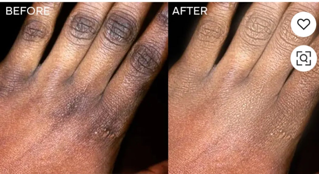 HUILE ECLAIRCISSANT HYPER PIGMENTATION