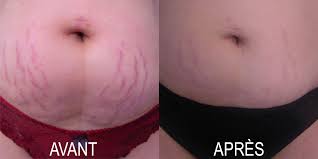LAZEL GLUTA PUR GLUTATHIONE 30 GELULES