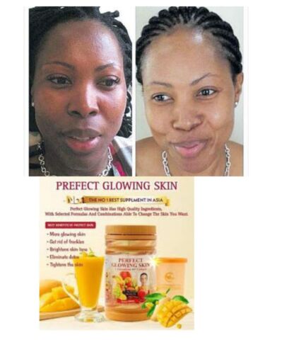 PERFECT GLOWING SKIN L GLUTATHIONE COLLAGÈNE ECLAIRCISSANT, X2 VITAMINE C ASCORBIC