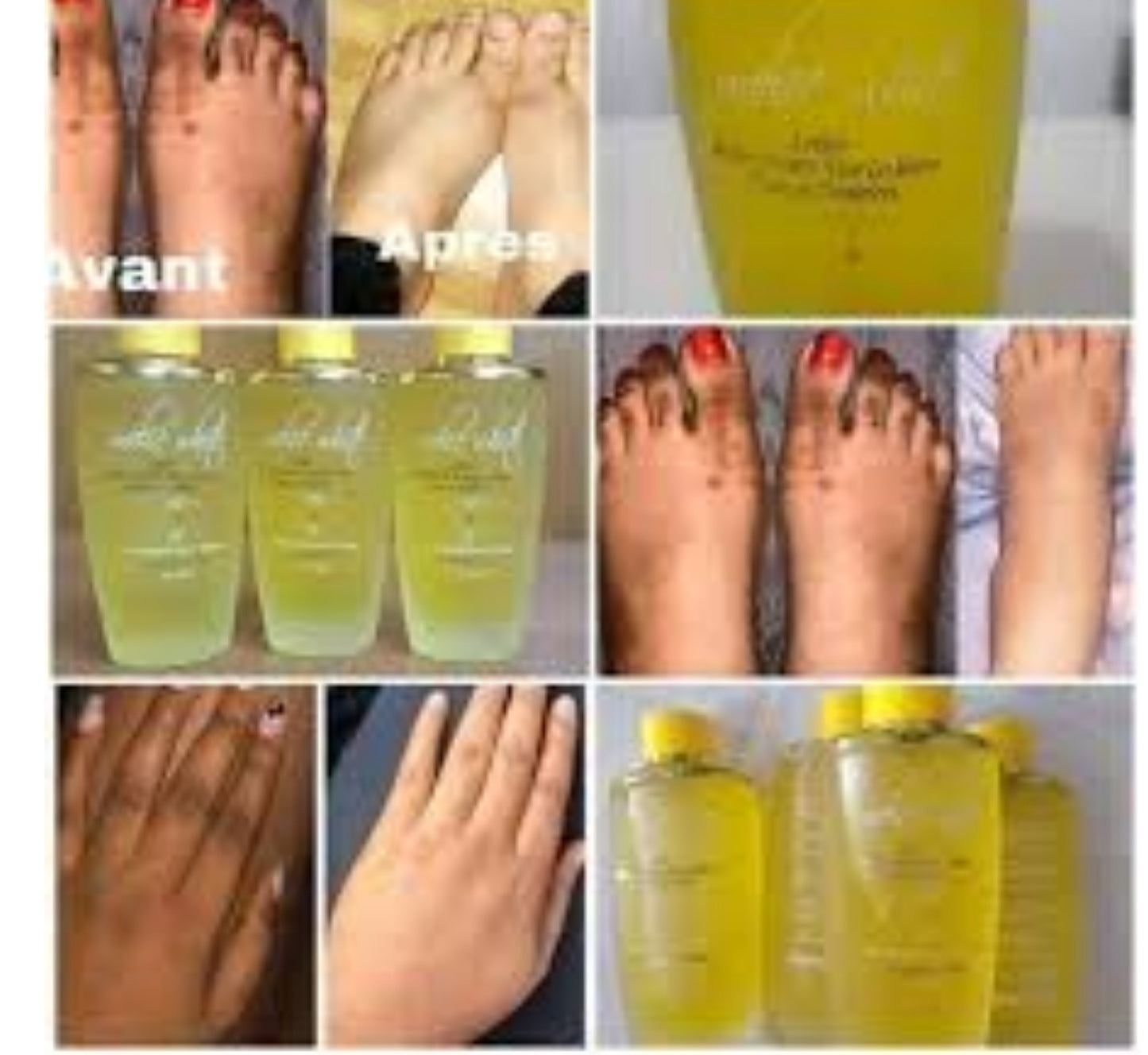 MELI WHITE LOTION ECLAIRCISSANT CONTRE LES TACHES SOMBRES ( QUINTOS GENOUX, COUDES...