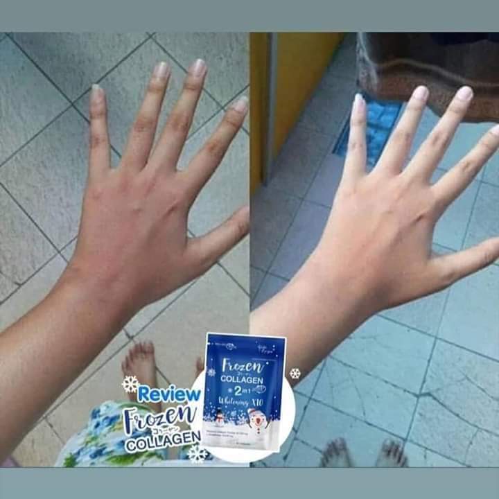 FROZEN COLLAGÈN GLUTATHIONE WHITENING CONTRE LES TÂCHES, LES BOUTONS ET VERGETURES 60 CAPSULES