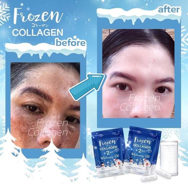 FROZEN COLLAGÈN GLUTATHIONE WHITENING CONTRE LES TÂCHES, LES BOUTONS ET VERGETURES 60 CAPSULES