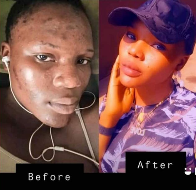 PHYTO MAGIC BRIGTHNING L GLUTATHIONE , RAISIN, COLLAGÈNE PEPTIDES GLOWING