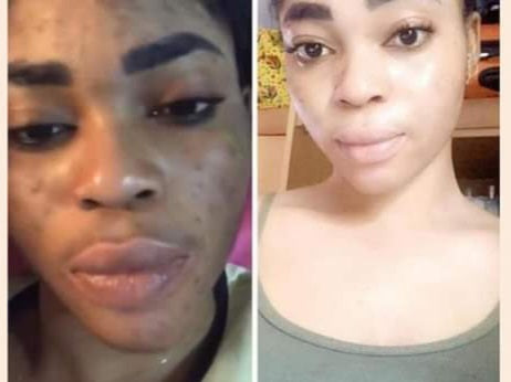 Crème visage blanchissante anti tâches clarifiant à base de glutathione alpha arbutin Kojic acide collagène et vitamine E