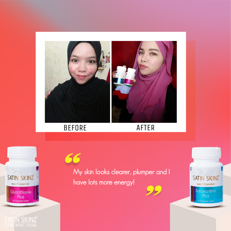 Satin skinz glutathione blanchissant 120 comprimés