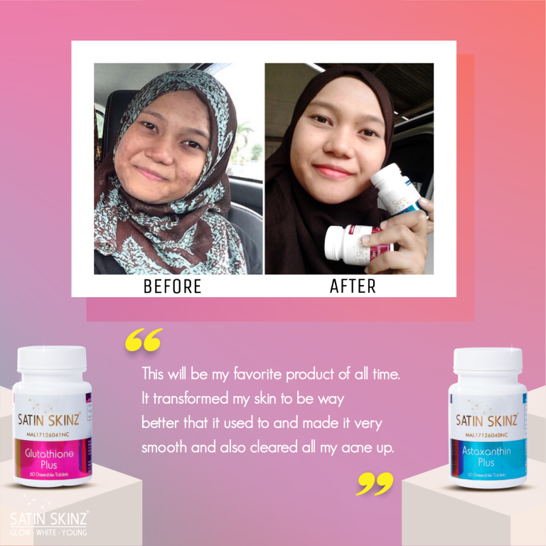Satin skinz glutathione blanchissant 120 comprimés