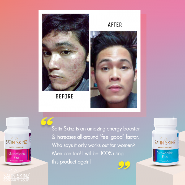Satin skinz glutathione blanchissant 120 comprimés