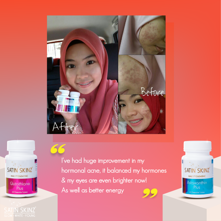 Satin skinz glutathione blanchissant 120 comprimés