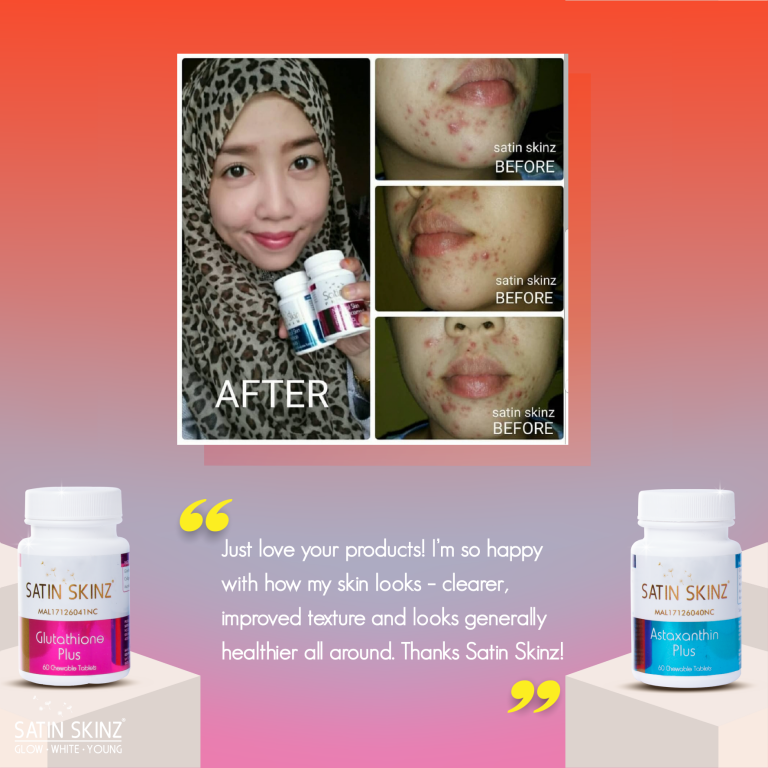 Satin skinz glutathione blanchissant 120 comprimés