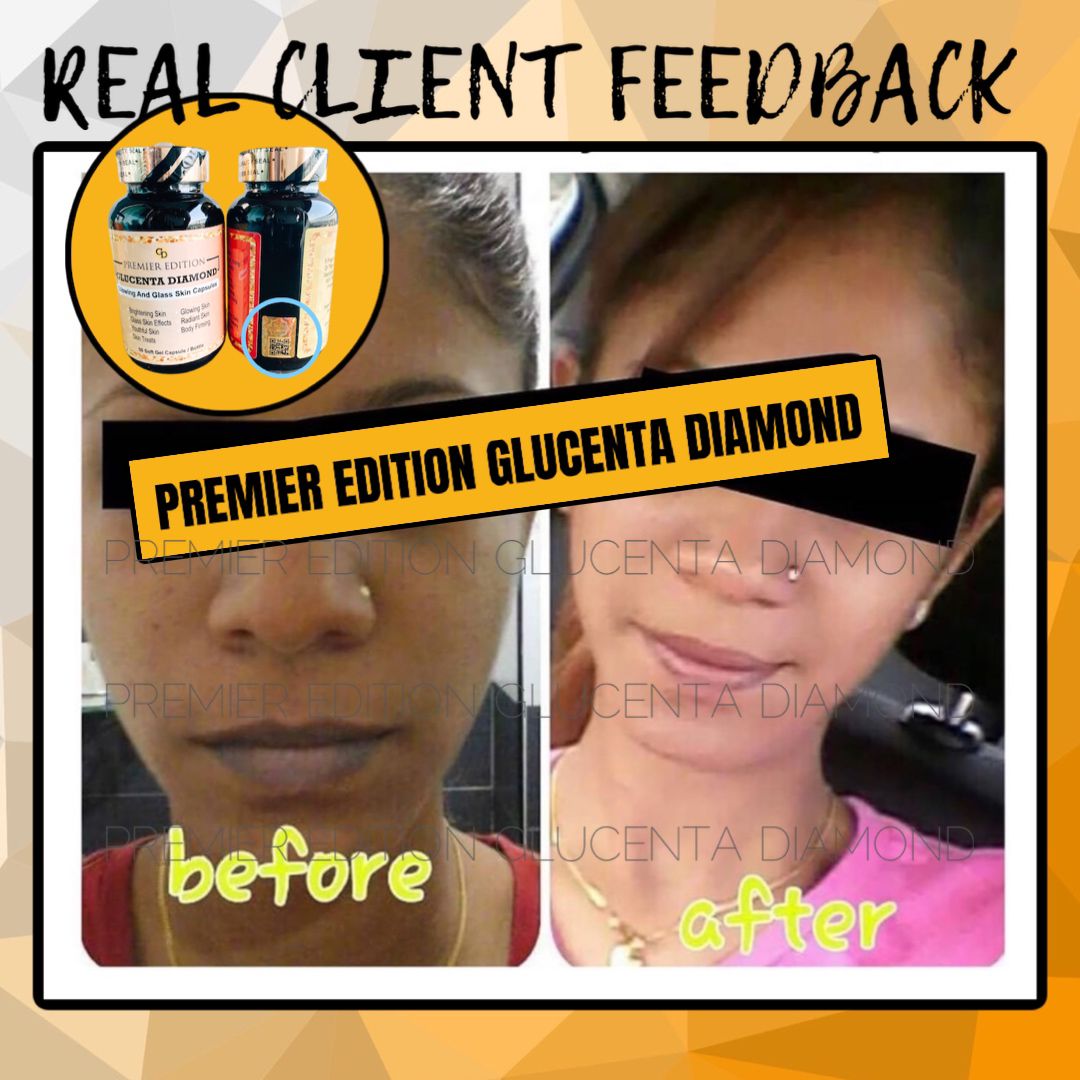 Glucenta Diamond Glutathione 60 gélules Blanchissant Anti imperfections