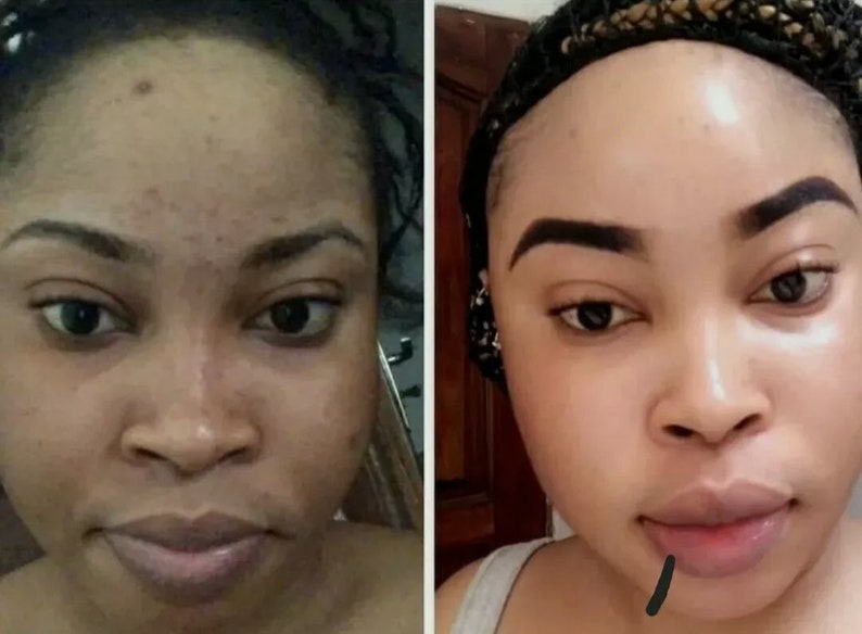 Crème visage blanchissante anti tâches clarifiant à base de glutathione alpha arbutin Kojic acide collagène et vitamine E