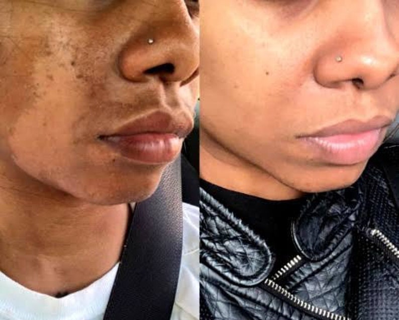 Crème visage blanchissante anti tâches clarifiant à base de glutathione alpha arbutin Kojic acide collagène et vitamine E