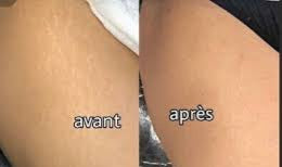 SEANERGY VERGETURES CRÈME RÉPARATRICE ET RÉGÉNÉRANT À BASE DES BAVES D'ESCARGOT 300ml