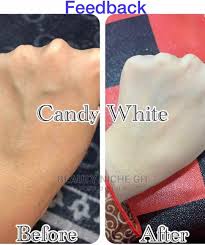 Phyto CERAMIDES CANDY WHITE COLLAGÈNE WHITENING glutathion blanchissant