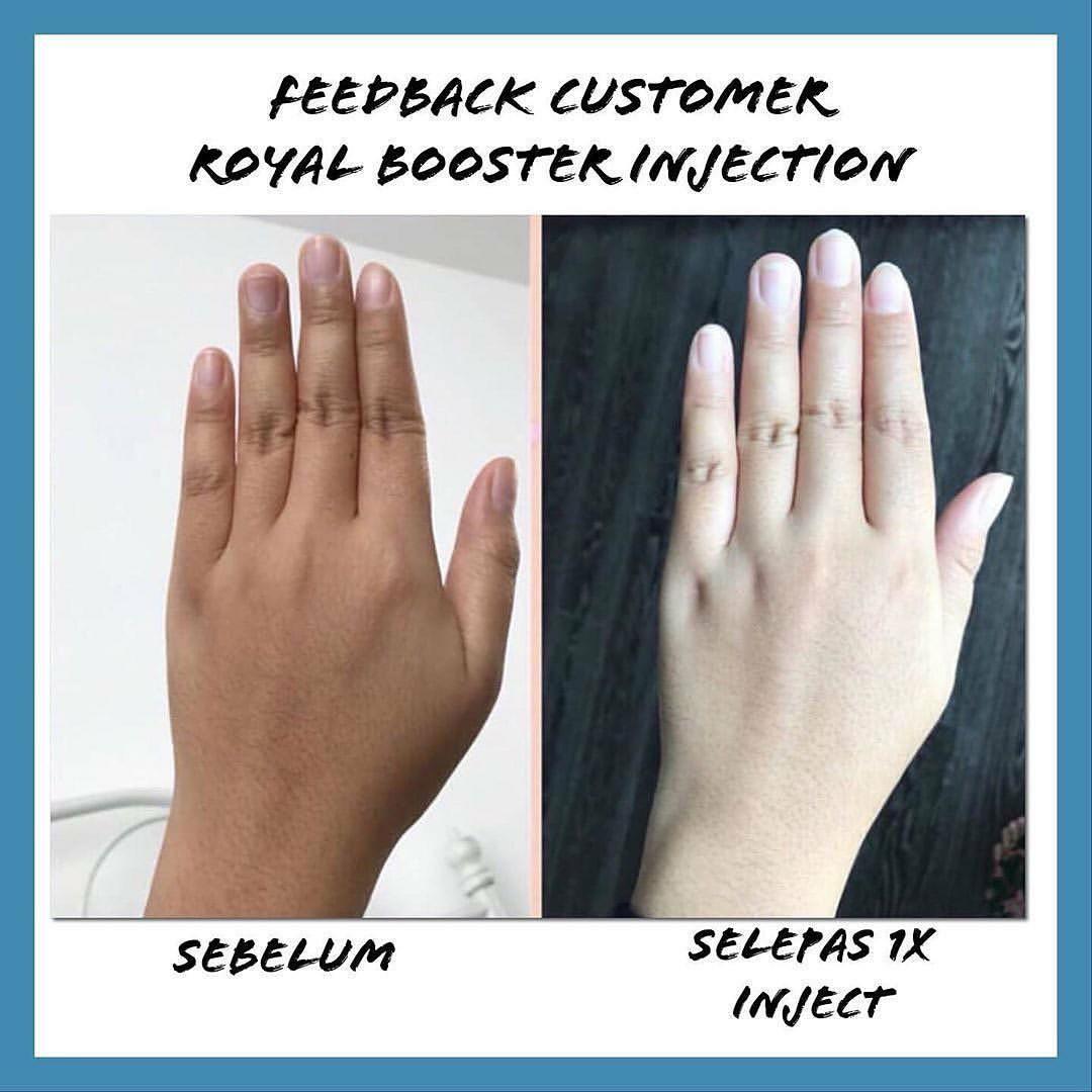 ROYAL BOOSTER SUPER WHITENING INJECTION BLANCHISSANT AUTHENTIQUE