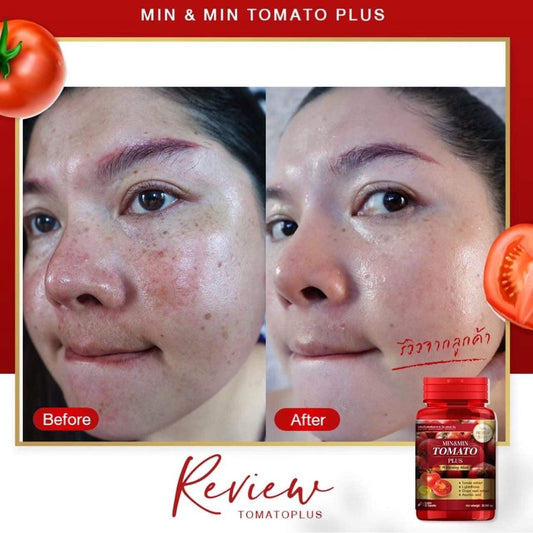 Gelules Blanchissantes Tomato Min Min Detoxifiantes Anti Oxydantes