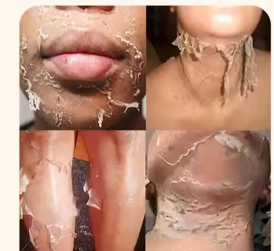 HUILE PEELING RÉGÉNÉRANT 100ML