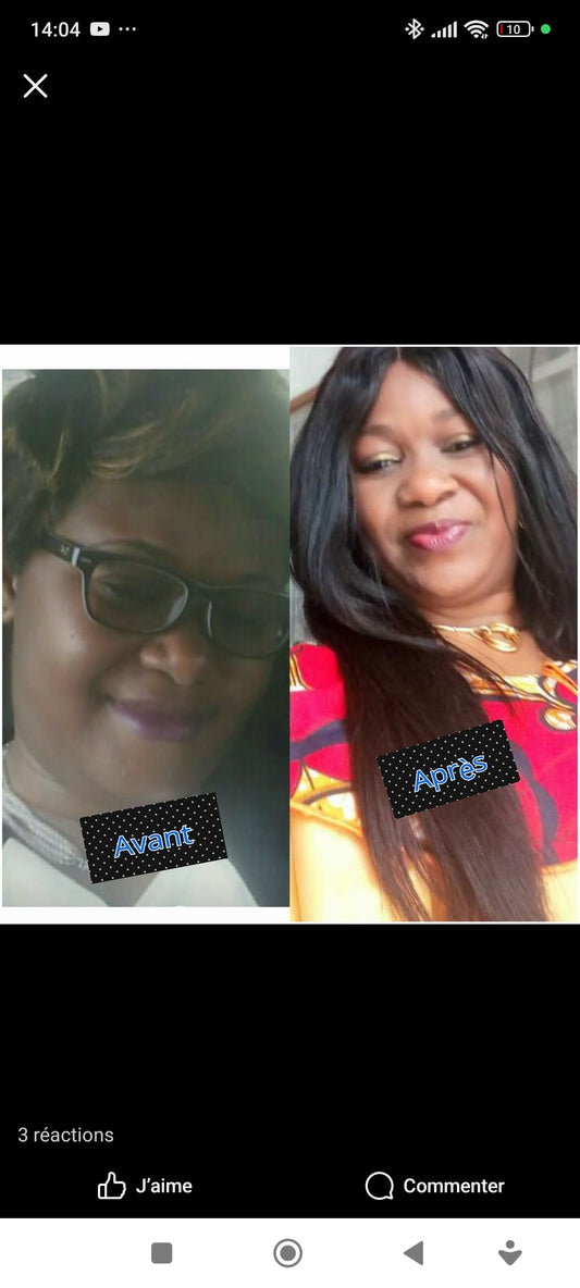 CRÈME SUPER ÉCLAIRCISSANTE VISAGE ET CORPS ANTI HYPERPIGMENTATION 300ML