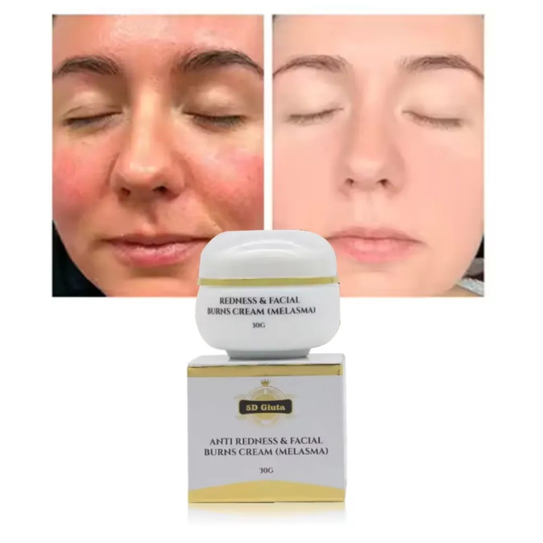 CRÈME ECLAIRCISSANTE VISAGE 5D GLUTA, HYPERPIGMENTATION, TÂCHES  30g