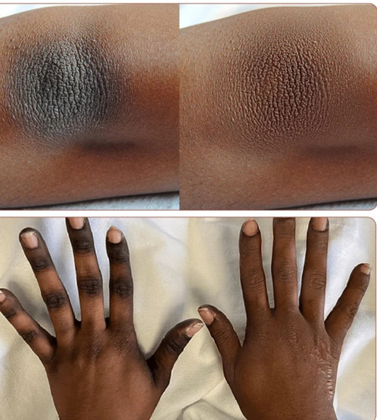 HUILE ECLAIRCISSANT HYPER PIGMENTATION