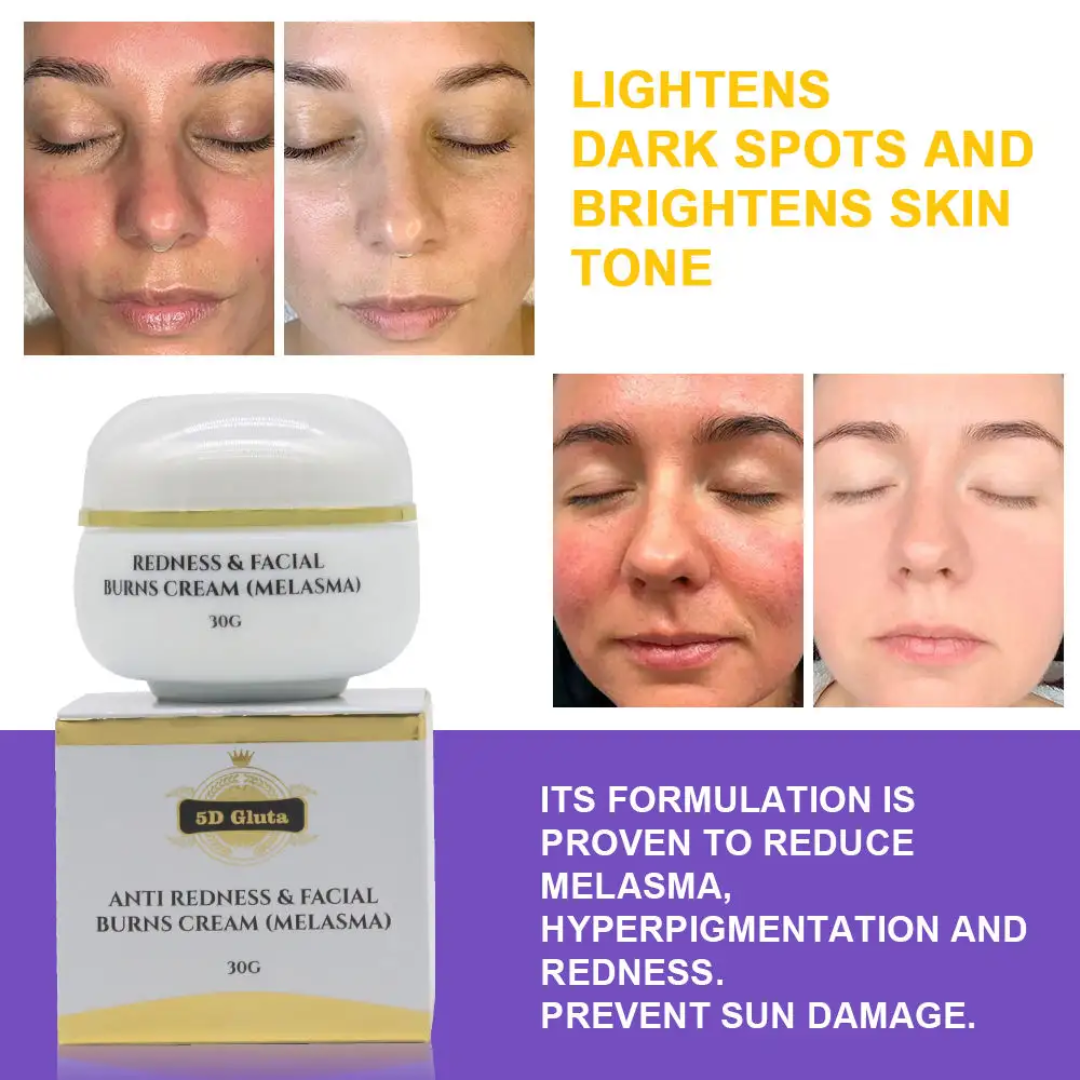 CRÈME ECLAIRCISSANTE VISAGE 5D GLUTA, HYPERPIGMENTATION, TÂCHES  30g
