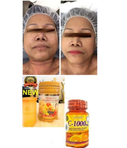 PERFECT GLOWING SKIN L GLUTATHIONE POUDRE BLANCHISSANTE,  VITAMINE C ASCORBIC 1000MG