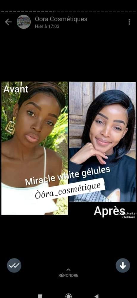 Miracle White gélules blanchissant, glutathione,  kojic, Vitamine C...