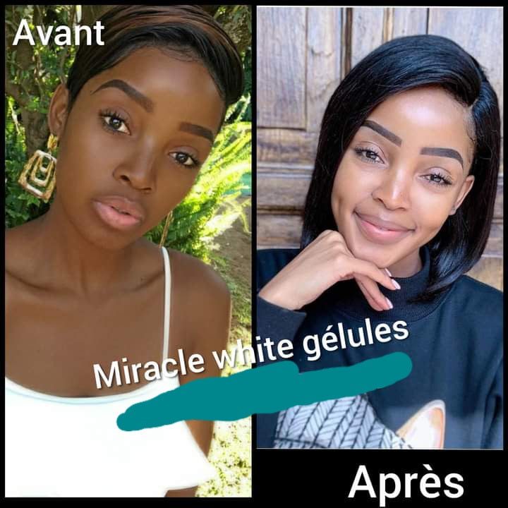 Miracle White gélules blanchissant, glutathione,  kojic, Vitamine C...