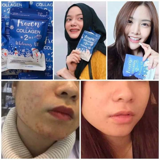 FROZEN COLLAGÈN GLUTATHIONE WHITENING CONTRE LES TÂCHES, LES BOUTONS ET VERGETURES 60 CAPSULES