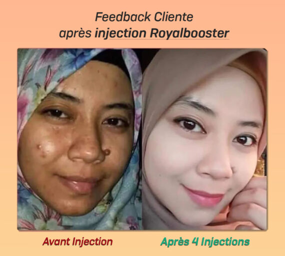 ROYAL BOOSTER SUPER WHITENING INJECTION BLANCHISSANT AUTHENTIQUE