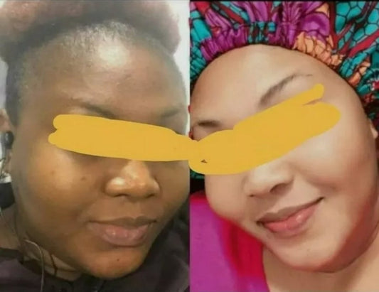 Crème visage blanchissante anti tâches clarifiant à base de glutathione alpha arbutin Kojic acide collagène et vitamine E