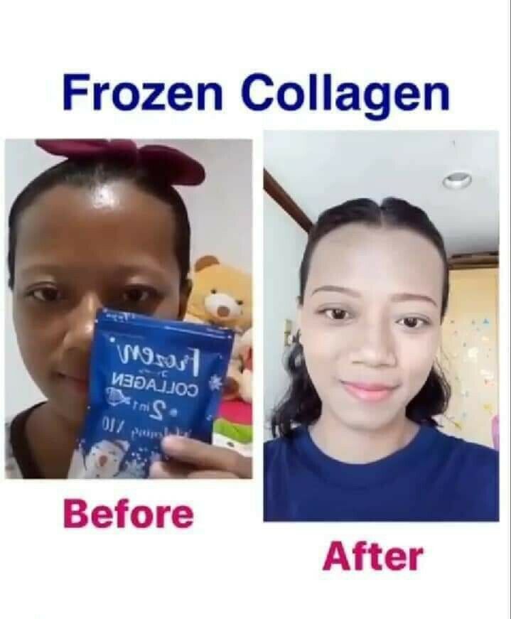 Frozen collagène glutathione blanchissante, vitamine c ascobic