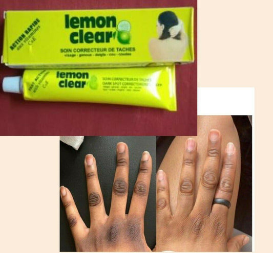 Lemon clear tube crème éclaircissant anti taches sur le doigt, tâches rebelles