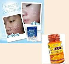 Frozen collagèn glutathione whitening, Vitamine C ascorbic 30 comprimés